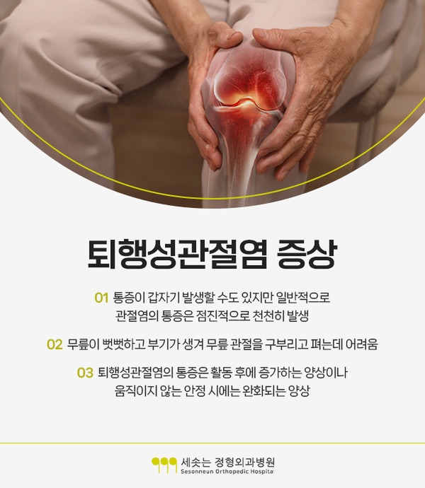 퇴행성관절염 증상 세 가지 — 통증이 갑자기 발생할 수도 있지만 일반적으로 관절염의 통증은 점진적으로 천천히 발생하고, 무릎이 뻣뻣하고 부기가 생겨 무릎 관절을 구부리고 펴는 데 어려움이 있으며, 통증은 활동 후에 증가하는 양상이나 움직이지 않는 안정 시에는 완화되는 양상이라는 설명
